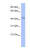 Origin Recognition Complex Subunit 4 antibody, NBP1-58167, Novus Biologicals, Western Blot image 