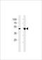 T-Box 4 antibody, LS-C157154, Lifespan Biosciences, Western Blot image 