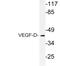 Vascular Endothelial Growth Factor D antibody, PA5-75448, Invitrogen Antibodies, Western Blot image 