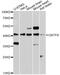 Ciliary Neurotrophic Factor Receptor antibody, MBS128115, MyBioSource, Western Blot image 