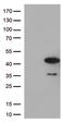 Protein Kinase AMP-Activated Non-Catalytic Subunit Beta 1 antibody, LS-C793199, Lifespan Biosciences, Western Blot image 