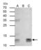 Beta-2-Microglobulin antibody, GTX112815, GeneTex, Immunoprecipitation image 