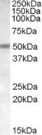 Cholinergic Receptor Nicotinic Beta 3 Subunit antibody, NB100-94886, Novus Biologicals, Western Blot image 