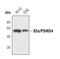 Proteasome 26S Subunit, Non-ATPase 4 antibody, PA5-17259, Invitrogen Antibodies, Western Blot image 
