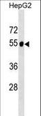 Glutamic--Pyruvic Transaminase 2 antibody, LS-C159781, Lifespan Biosciences, Western Blot image 