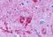 Endothelin Receptor Type B antibody, GTX12980, GeneTex, Immunohistochemistry paraffin image 