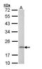 Adaptor Related Protein Complex 1 Subunit Sigma 2 antibody, GTX109314, GeneTex, Western Blot image 