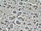 ADP Ribosylation Factor Like GTPase 13B antibody, 17711-1-AP, Proteintech Group, Immunohistochemistry paraffin image 