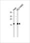 NME1 antibody, 58-112, ProSci, Western Blot image 