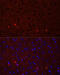 Glutamate Ionotropic Receptor AMPA Type Subunit 2 antibody, 13-036, ProSci, Immunofluorescence image 
