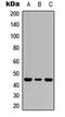 Interleukin 1 Receptor Type 2 antibody, LS-C356122, Lifespan Biosciences, Western Blot image 