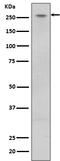 Leucine Rich Repeat Kinase 2 antibody, M00221-2, Boster Biological Technology, Western Blot image 