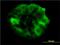 SHC Adaptor Protein 1 antibody, H00006464-M01, Novus Biologicals, Immunocytochemistry image 