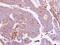 G Protein Subunit Alpha I1 antibody, GTX105292, GeneTex, Immunohistochemistry paraffin image 