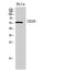 Ectonucleoside Triphosphate Diphosphohydrolase 1 antibody, STJ97281, St John