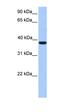 Meis Homeobox 1 antibody, orb329966, Biorbyt, Western Blot image 