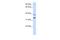 Solute Carrier Family 25 Member 34 antibody, A16597, Boster Biological Technology, Western Blot image 