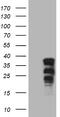SRY-Box 21 antibody, M10098, Boster Biological Technology, Western Blot image 