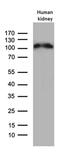 Angiotensin I Converting Enzyme 2 antibody, MA5-26629, Invitrogen Antibodies, Western Blot image 