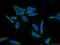 Coiled-coil domain-containing protein 85B antibody, 18282-1-AP, Proteintech Group, Immunofluorescence image 