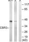 Carbonyl Reductase 3 antibody, LS-C119817, Lifespan Biosciences, Western Blot image 