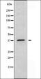 Protein Kinase CAMP-Activated Catalytic Subunit Alpha antibody, orb228089, Biorbyt, Western Blot image 