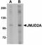 Lysine Demethylase 4A antibody, LS-B5034, Lifespan Biosciences, Western Blot image 