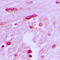 Basic Transcription Factor 3 Like 4 antibody, LS-C354212, Lifespan Biosciences, Immunohistochemistry paraffin image 