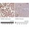 Hydroxyacyl-CoA Dehydrogenase Trifunctional Multienzyme Complex Subunit Beta antibody, NBP2-38353, Novus Biologicals, Immunohistochemistry paraffin image 