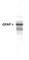 GFAP antibody, TA336611, Origene, Western Blot image 