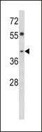 Transducer Of ERBB2, 2 antibody, 62-212, ProSci, Western Blot image 