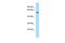 D-2-Hydroxyglutarate Dehydrogenase antibody, PA5-45860, Invitrogen Antibodies, Western Blot image 