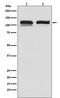 Ubiquitin Specific Peptidase 11 antibody, M05225, Boster Biological Technology, Western Blot image 
