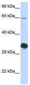 Zinc Finger Protein 630 antibody, TA345637, Origene, Western Blot image 
