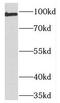 Testis Expressed 10 antibody, FNab08604, FineTest, Western Blot image 