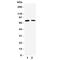 Transglutaminase 2 antibody, R31273, NSJ Bioreagents, Western Blot image 