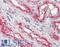 FER Tyrosine Kinase antibody, LS-B3467, Lifespan Biosciences, Immunohistochemistry frozen image 