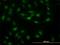 Signal Transducer And Activator Of Transcription 5B antibody, H00006777-M03, Novus Biologicals, Immunofluorescence image 