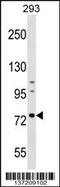 Arginyl Aminopeptidase antibody, 59-126, ProSci, Western Blot image 