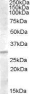 Insulin Like Growth Factor Binding Protein 4 antibody, GTX88775, GeneTex, Western Blot image 