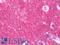 Signal Transducing Adaptor Molecule antibody, LS-B10824, Lifespan Biosciences, Immunohistochemistry frozen image 