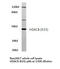 Histone Deacetylase 8 antibody, LS-C176062, Lifespan Biosciences, Western Blot image 