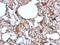 Melanoma Cell Adhesion Molecule antibody, NBP2-48198, Novus Biologicals, Immunohistochemistry paraffin image 