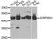 Alpha-1-antitrypsin antibody, LS-C747582, Lifespan Biosciences, Western Blot image 
