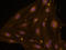 Endoglin antibody, AF1320, R&D Systems, Immunofluorescence image 