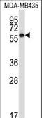 Protein Disulfide Isomerase Family A Member 5 antibody, LS-C163486, Lifespan Biosciences, Western Blot image 