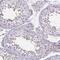 UL16 Binding Protein 3 antibody, PA5-64083, Invitrogen Antibodies, Immunohistochemistry frozen image 