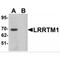 Leucine Rich Repeat Transmembrane Neuronal 1 antibody, MBS150737, MyBioSource, Western Blot image 