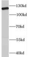 RNA Binding Motif Protein 19 antibody, FNab07168, FineTest, Western Blot image 