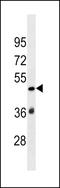 SP140 Nuclear Body Protein Like antibody, LS-C159066, Lifespan Biosciences, Western Blot image 